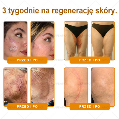 Polecane przez USK w Białymstoku · Wyprodukowano w Polsce✨✨ 𝖠𝖯𝖪𝖠𝖯𝖪® krem regenerujący skórę z jadem pszczelim✨✨