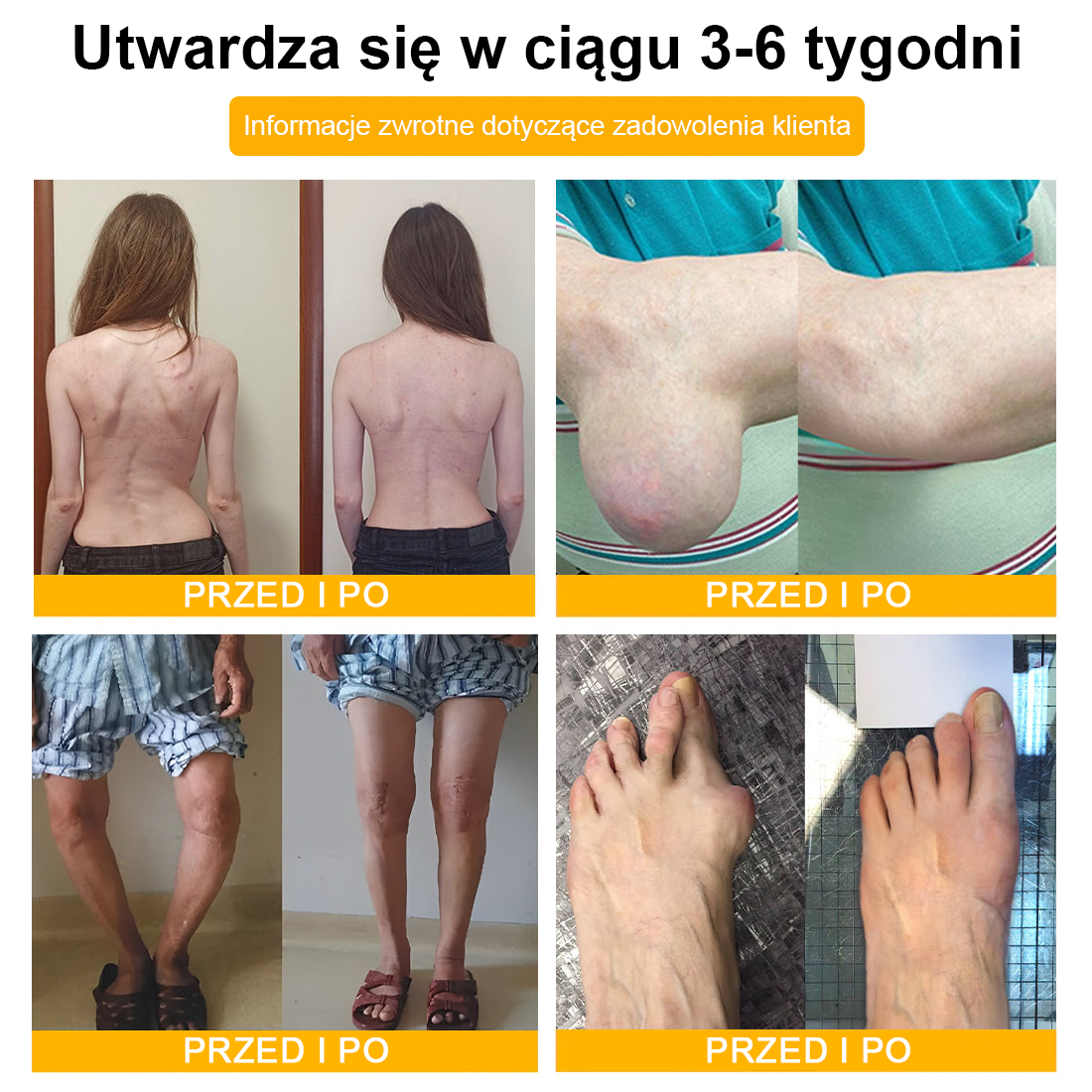 🦴𝑷𝒖𝒓𝐞𝐿𝒖𝒙𝐨® Toksyna botulinowa i jad pszczeli Krem przeciwbólowy do gojenia kości🦴🔥🔥