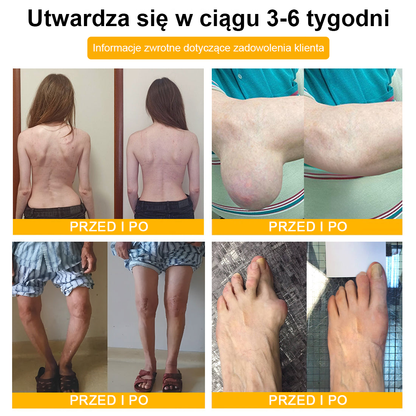 🦴𝑷𝒖𝒓𝐞𝐿𝒖𝒙𝐨® Toksyna botulinowa i jad pszczeli Krem przeciwbólowy do gojenia kości🦴🔥🔥