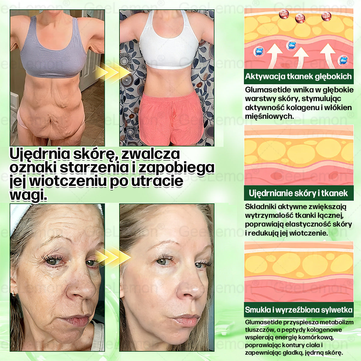 👩‍⚕️Oficjalny Sklep | 🎁 Pureluxo® 𝐆𝐥𝐮𝐦ase𝐭𝐢𝐝𝐞 𝟖 𝐰 𝟏 Smukły i Zdrowy Nano Plaster z Mikronakłuciami 🇵🇱(Tylko raz dziennie, widoczne zmiany już w 7 dni)✅ Na otyłość, 🅛🅞🅞🅢🅔 🅢🅚🅘🅝 wiotką skórę, cukrzycę, bezdech senny, problemy ze stawami i wiele więcej🎅🎄