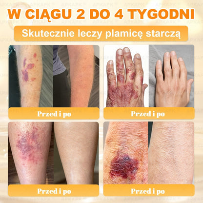 Polecane przez USK w Białymstoku · Wyprodukowano w Polsce✨✨ 𝖠𝖯𝖪𝖠𝖯𝖪® krem regenerujący skórę z jadem pszczelim✨✨