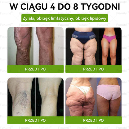Oficjalny Sklep 👩‍⚕️👩‍⚕️Funutri® 10 w 1 metaboliczny wyszczuplający plaster z nanomikroigłami  (Tylo raz dziennie – widoczne zmiany już w 7 dni)Wsparcie przy otyłości, cukrzycy, bezdechu sennym, problemach ze stawami i nie tylko👩‍⚕️