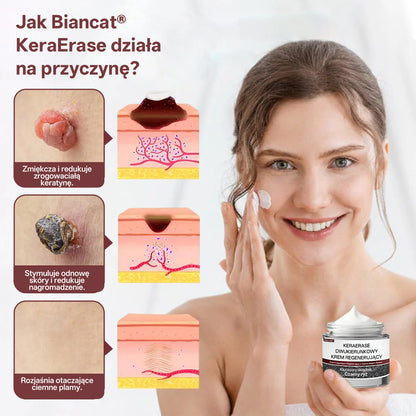 Pureluxo®KeraErase Krem odnawiający o podwójnym działaniu🔥🔥