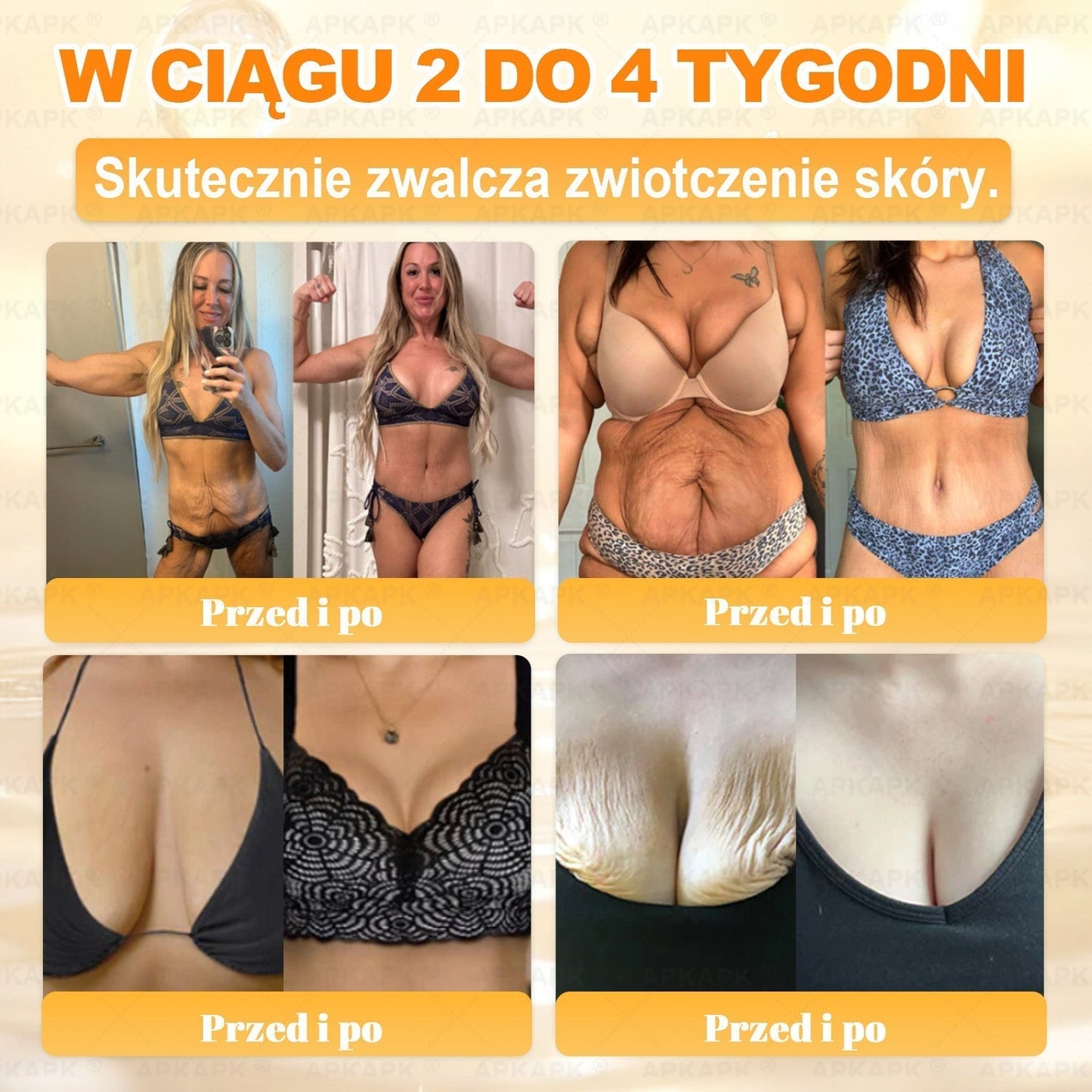 Polecane przez USK w Białymstoku · Wyprodukowano w Polsce✨✨ 𝖠𝖯𝖪𝖠𝖯𝖪® krem regenerujący skórę z jadem pszczelim✨✨