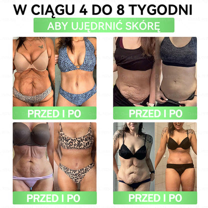 👩‍⚕️Oficjalny Sklep | 🎁 Pureluxo® 𝐆𝐥𝐮𝐦ase𝐭𝐢𝐝𝐞 𝟖 𝐰 𝟏 Smukły i Zdrowy Nano Plaster z Mikronakłuciami 🇵🇱(Tylko raz dziennie, widoczne zmiany już w 7 dni)✅ Na otyłość, 🅛🅞🅞🅢🅔 🅢🅚🅘🅝 wiotką skórę, cukrzycę, bezdech senny, problemy ze stawami i wiele więcej🎅🎄