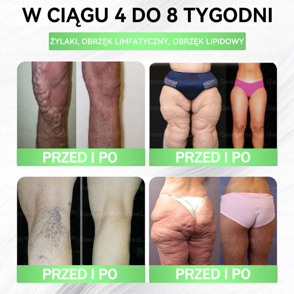 👩‍⚕️Oficjalny Sklep | 🎁 Pureluxo® 𝐆𝐥𝐮𝐦ase𝐭𝐢𝐝𝐞 𝟖 𝐰 𝟏 Smukły i Zdrowy Nano Plaster z Mikronakłuciami 🇵🇱(Tylko raz dziennie, widoczne zmiany już w 7 dni)✅ Na otyłość, 🅛🅞🅞🅢🅔 🅢🅚🅘🅝 wiotką skórę, cukrzycę, bezdech senny, problemy ze stawami i wiele więcej🎅🎄