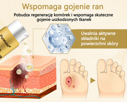 Pureluxo® Leczniczy spray do stóp cukrzycowych- zawiera jad pszczeli, który przyspiesza gojenie i zapobiega infekcjom!🌿