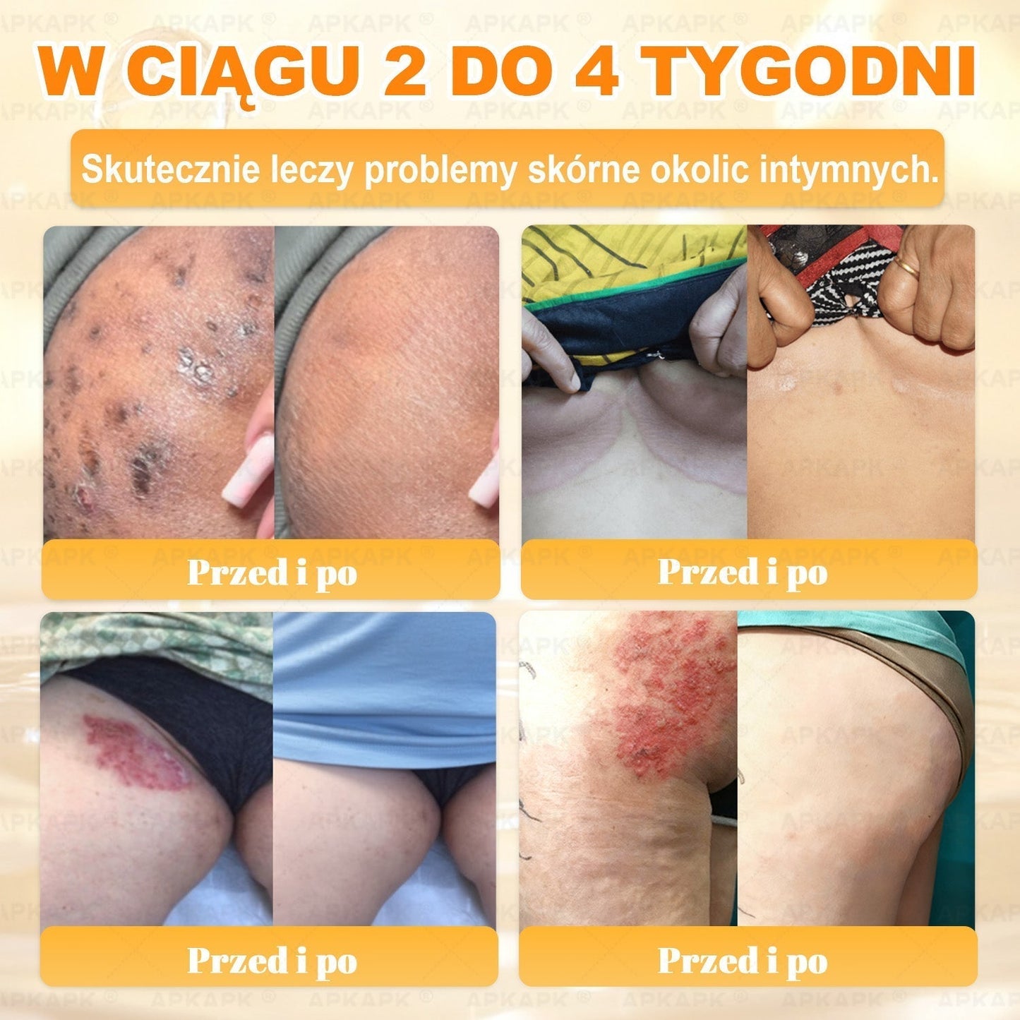 Polecane przez USK w Białymstoku · Wyprodukowano w Polsce✨✨ 𝖠𝖯𝖪𝖠𝖯𝖪® krem regenerujący skórę z jadem pszczelim✨✨