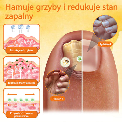 👣Spray z jadem pszczelim na paznokcie✅ Certyfikowany przez PTD👣