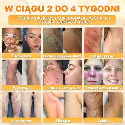 Polecane przez USK w Białymstoku · Wyprodukowano w Polsce✨✨ 𝖠𝖯𝖪𝖠𝖯𝖪® krem regenerujący skórę z jadem pszczelim✨✨