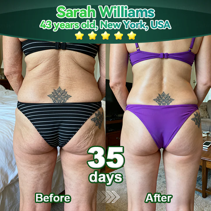 （Oficjalnie certyfikowane i wyłącznie autoryzowane）☘️ Pureluxo® Serum z komórkami macierzystymi i peptydami kolagenu 🪄 （Ujędrnia skórę i redukuje widoczność zmarszczek）☘️