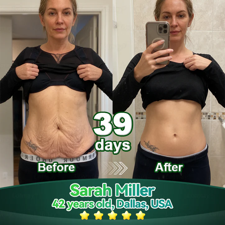 （Oficjalnie certyfikowane i wyłącznie autoryzowane）☘️ Pureluxo® Serum z komórkami macierzystymi i peptydami kolagenu 🪄 （Ujędrnia skórę i redukuje widoczność zmarszczek）☘️