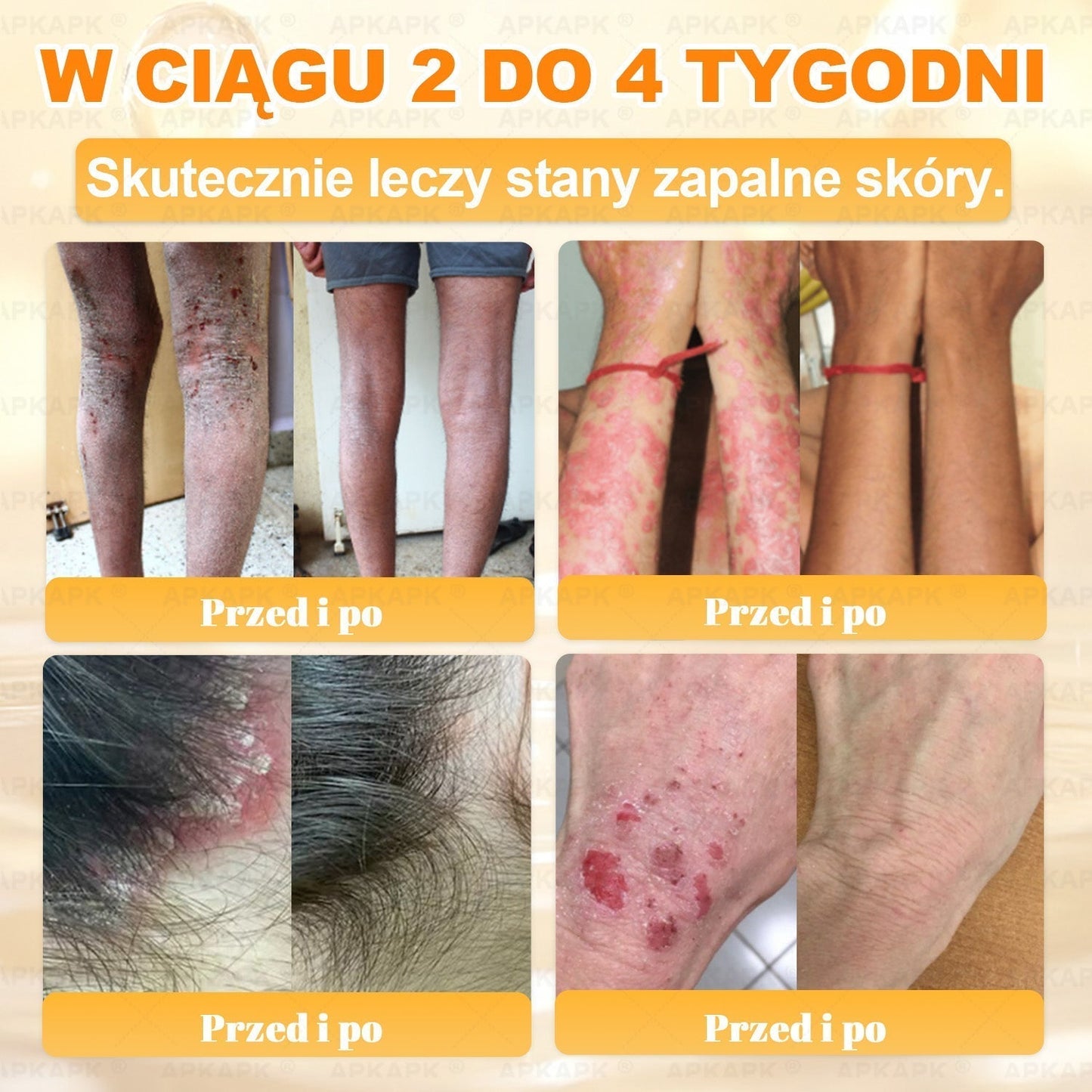 Polecane przez USK w Białymstoku · Wyprodukowano w Polsce✨✨ 𝖠𝖯𝖪𝖠𝖯𝖪® krem regenerujący skórę z jadem pszczelim✨✨